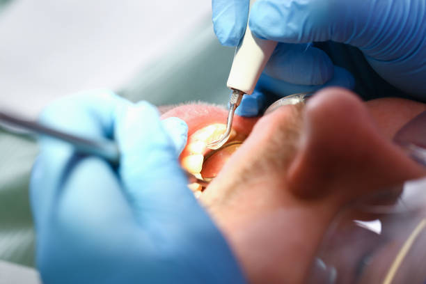 Best Emergency Broken Tooth Repair in Meadowbrook, VA